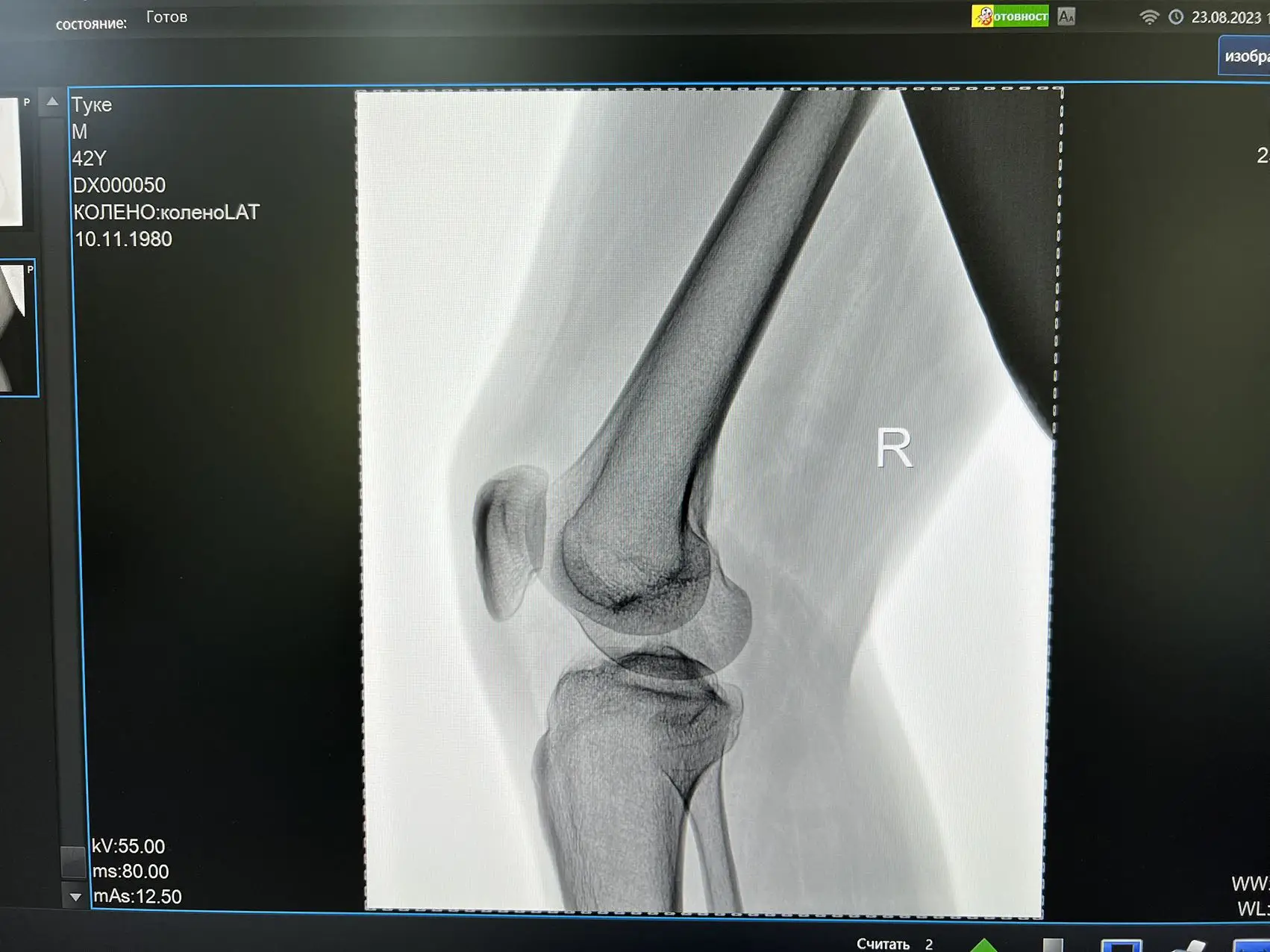 With Wholesale of new products  PLD5600A double column DR System Power supply frequency x-ray medical imaging machine
