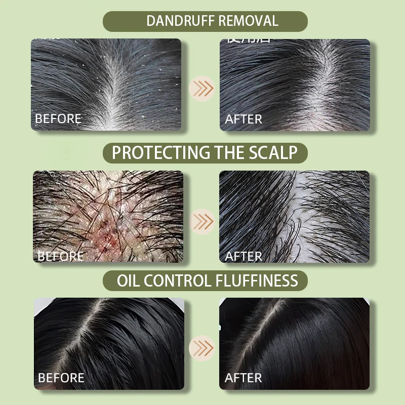 Contains rosemary, keratin, tea tree shampoo to clean and refresh, relieve itching and dandruff sulfate & paraben-free shampoo