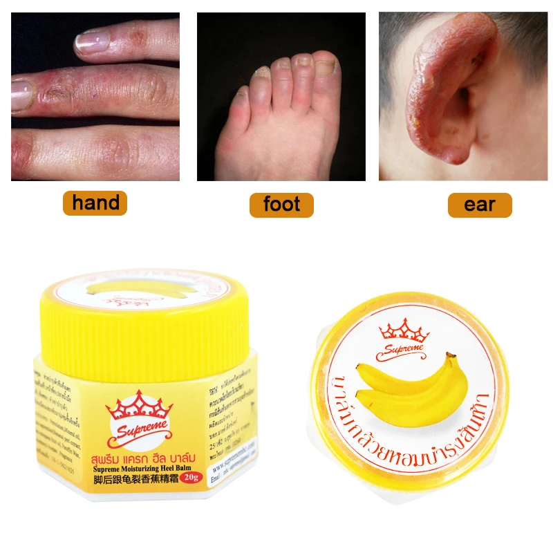 20g Skin Crack Healing Cream Moisturizing Anti-drying Repair Chapped Cream Prevent Skin Cracked Chilblain Peeling Ointment