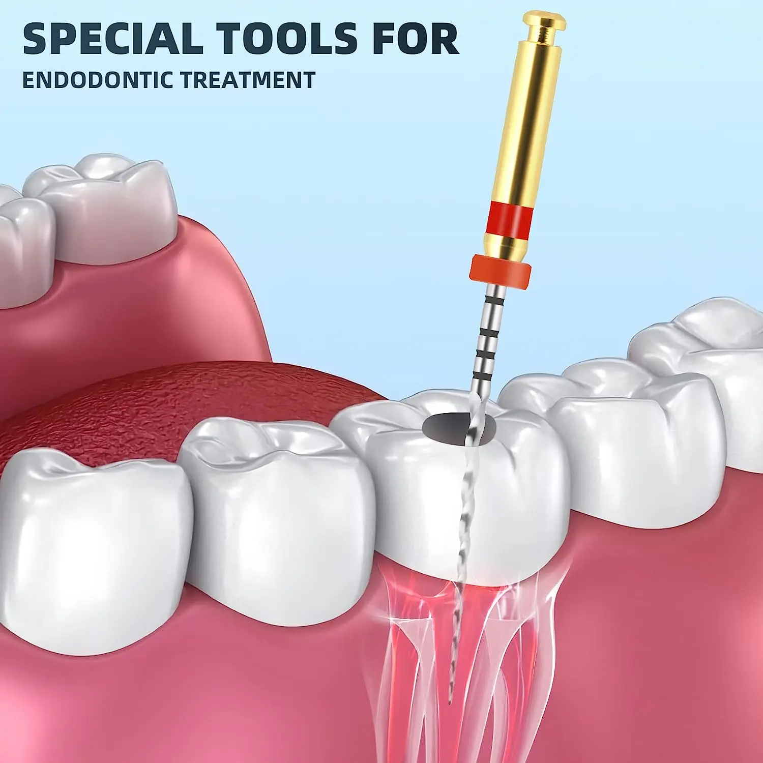 SJ Endodontic NiTi Super Files Universal Endo Rotary Steel File Dental Niti Rotary Root Canal Files OEM Wholesale