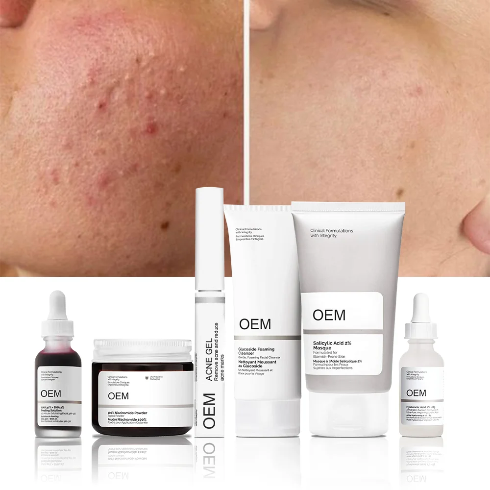 Ordinary Azelaic Acid 10% Gel Moisturizing Facial Cleanser For Acne Treatment Face-Cream Anti-Aging Wrinkles Repair Skin Care