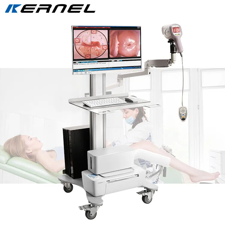 Kernel CCD 3.27 million Pixels Medical Digital Colposcope for Gynecology KN-2200IH