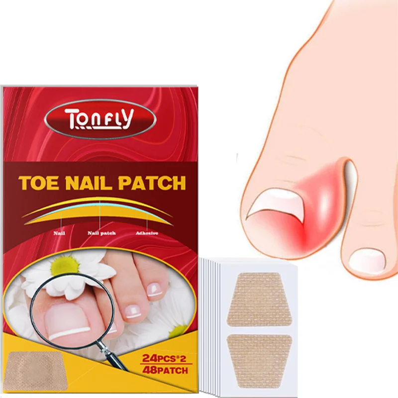 48Pcs Toenail Fungus Patch Breathable Nail Repair Patches Nail Ingrown Correction Stickers Waterproof Sticky Foot Care Tools