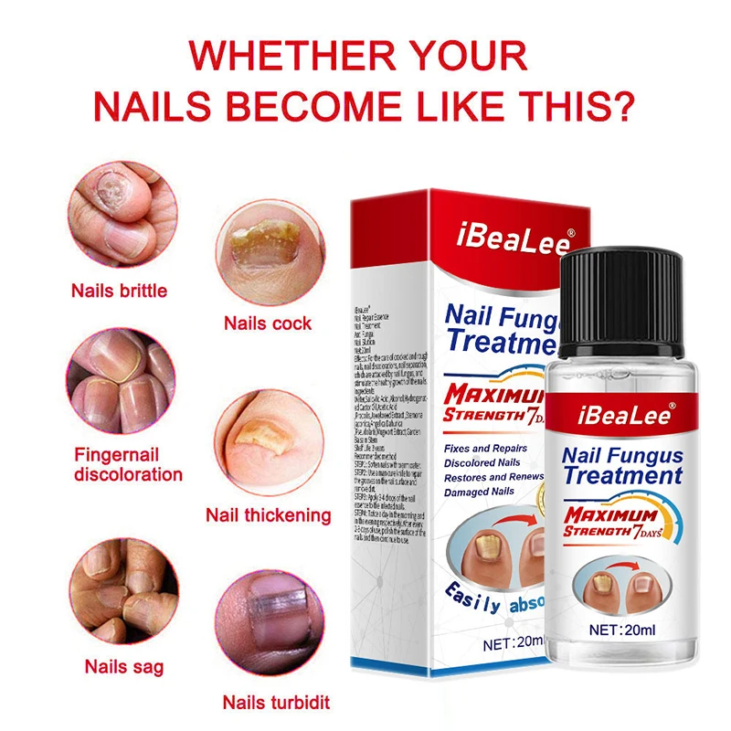 iBeaLee Nail Fungus Treatment 7DAYS Repair Essence Serum Hand Care Nails Foot Fungal Removal Cream Anti-infective Onychomycosis
