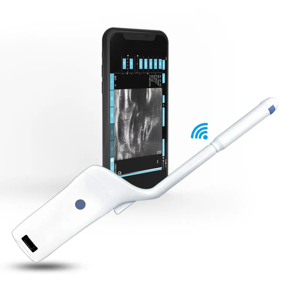 ecografos portatil rectal portable handheld ultrasound black and white doppler device ultrasound home