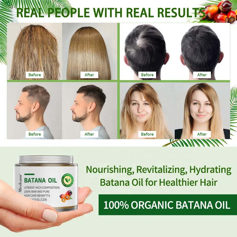 100% Natural Organic Batana Oil Cream For Hair Growth Treatment Hair Loss Alopecia Areata