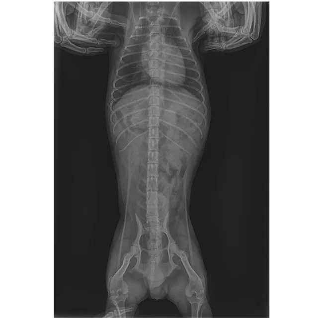 Медицинская больница 17*17 DR цифровой рентгеновский плоский панельный детектор рентгеновских снимков по