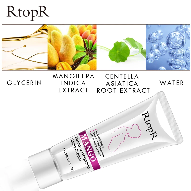 RtopR Amazon Hot Sale Best Natural Organic Mango Anti Vergeture Repair Scar Stretch Mark Removal Cream