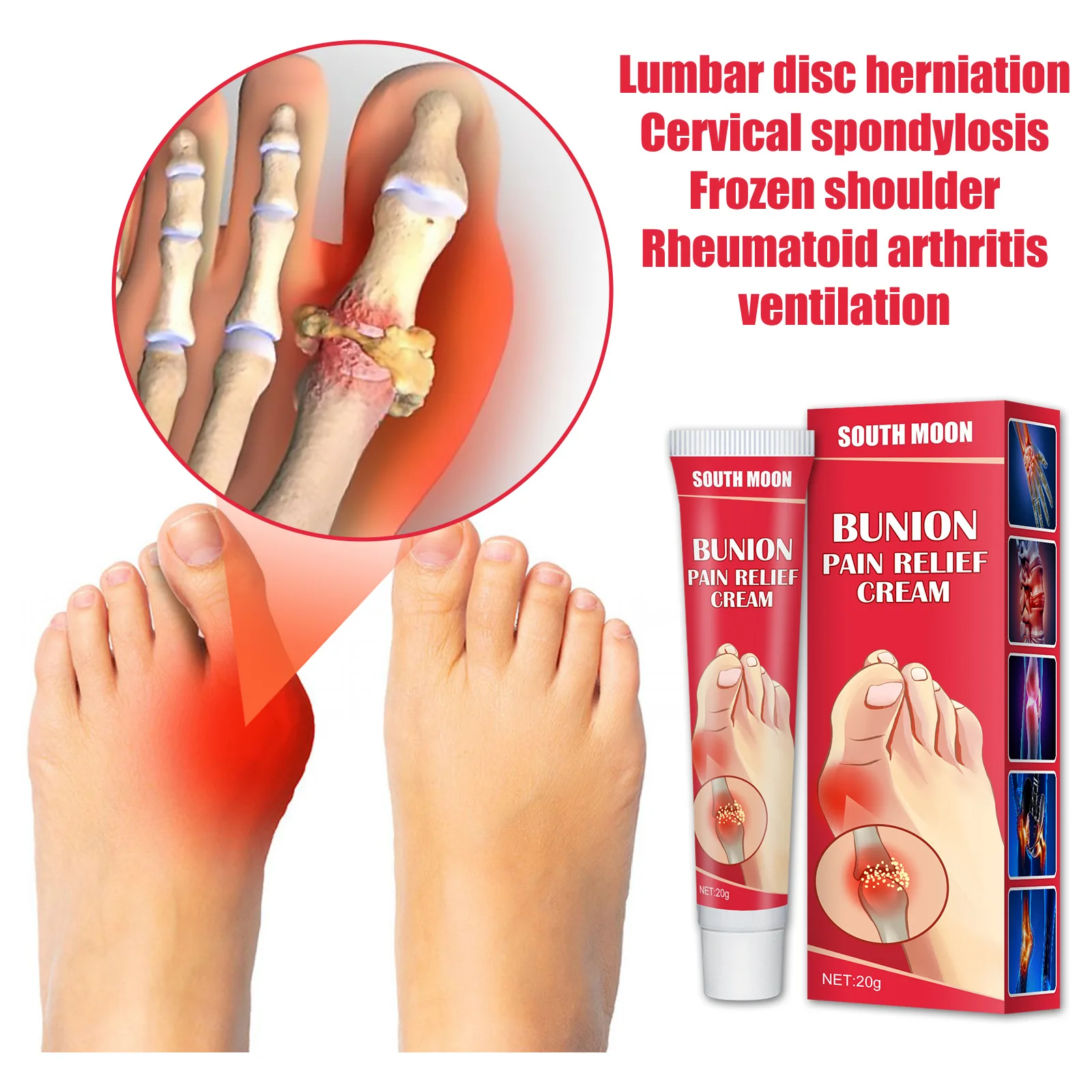 South Moon 20g Bunion Pain Relief Ointment Joint Toe Pain Cream Bunion Gout Pain Relief Stiffness Inflammation Treatment