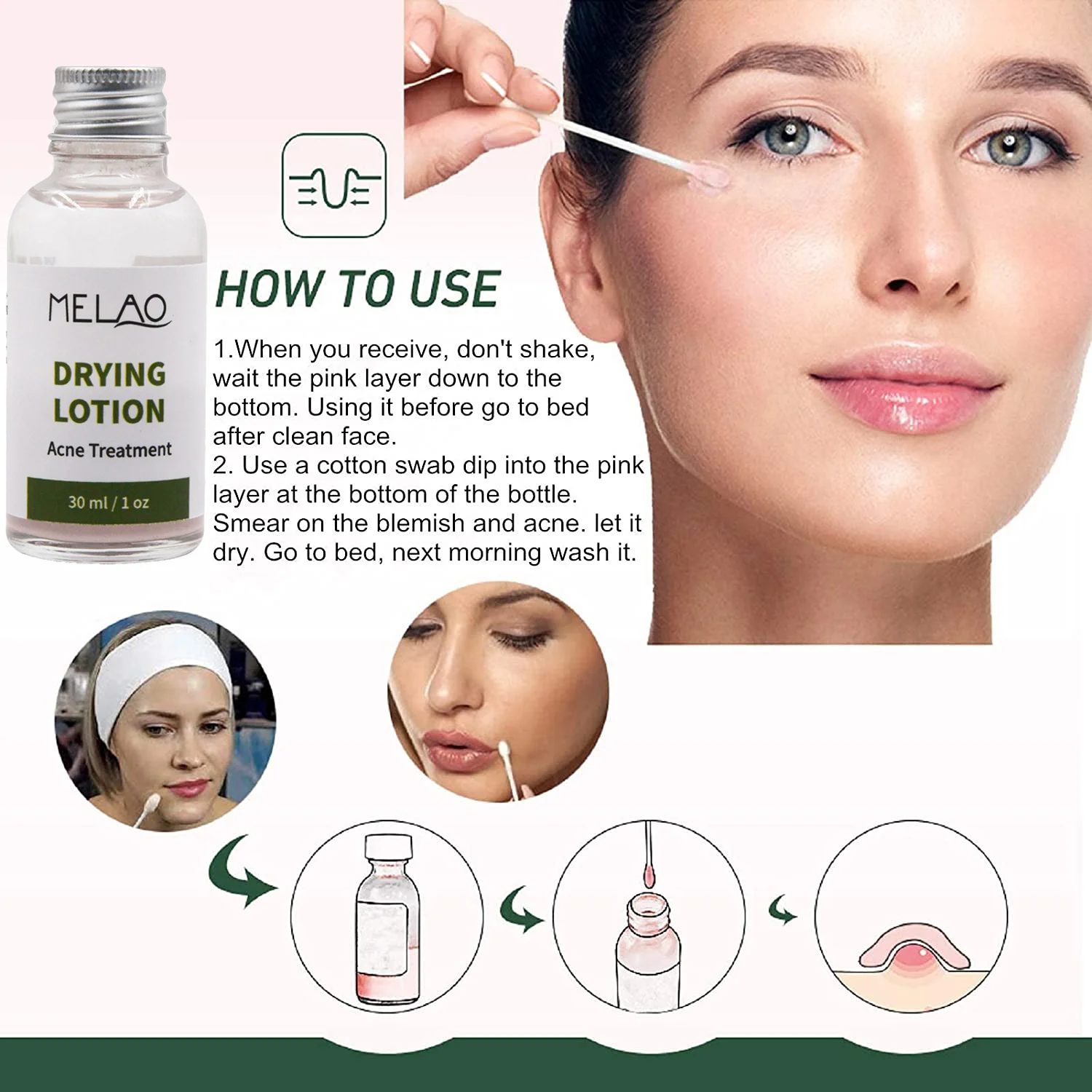 OEM/ODM High Quality Private Label Facial Care Natural Organic Acne Treatment MELAO Oil Balance Drying Lotion Acne Treatment