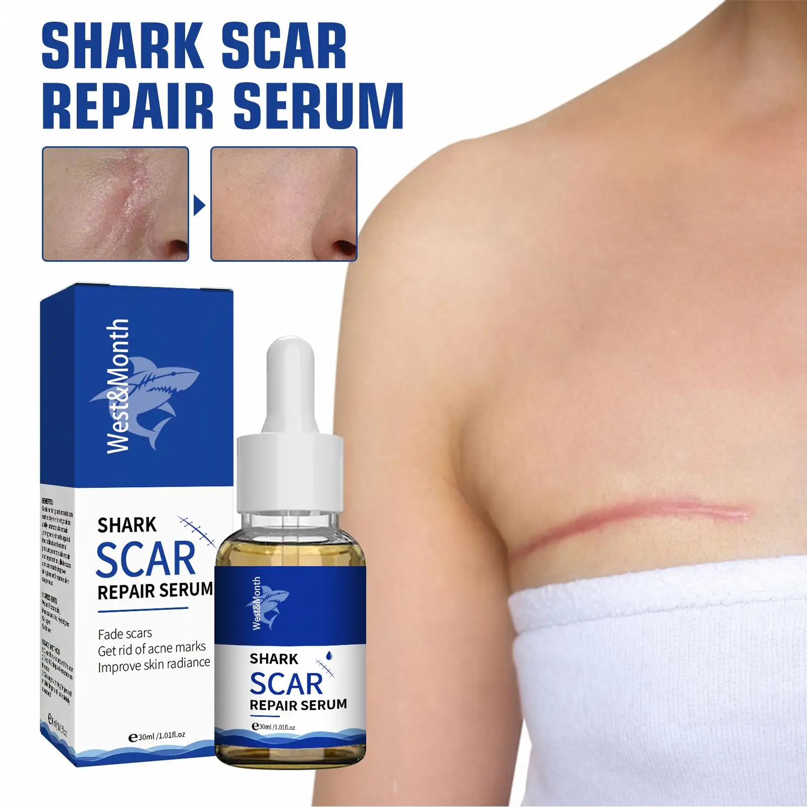 West Moon Wholesale Skin Care Scar Acne Mark Pimples Spots Repair Serum Shark Scar Treatment Oil Scar Removal Gel