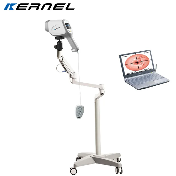 Kernel KN-2200A portable Optical Colposcope Gynecological Examination Vaginoscope optic colposcope colposcopy