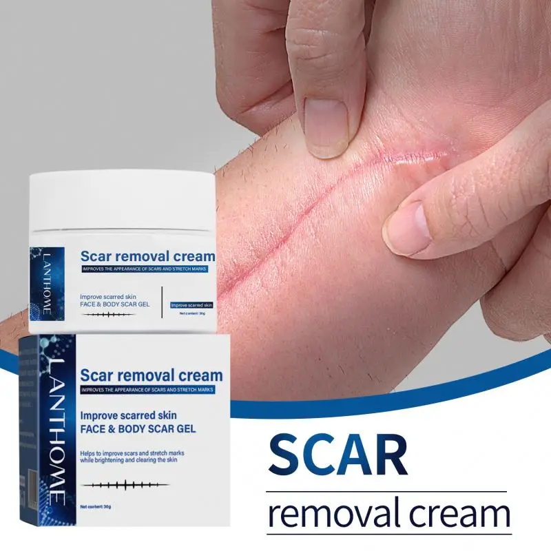 30g Old And Dark Spot On Leg Removal Cream Remove Postoperative Effectively Prevents Scar Proliferation After Surgery
