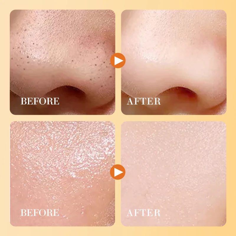 SADOER Hot Selling Skin Care Set Natural Organic Vitamin C Whitening Face Hand Eye Body Lotion Moisturizer Oil Exfoliating Gel