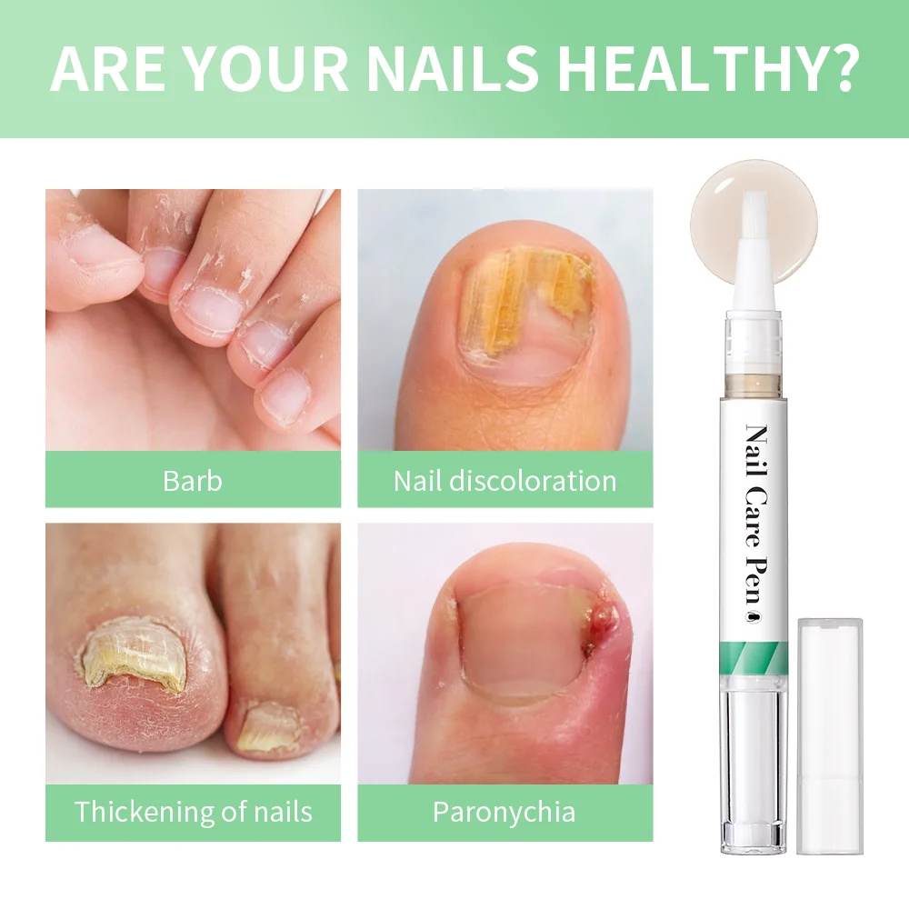 Private Label Soften Brush Pen Cuticle Oil Tool Nail Cuticle Oil Revitalizer Pen Manicure Care Essential Oil Moist