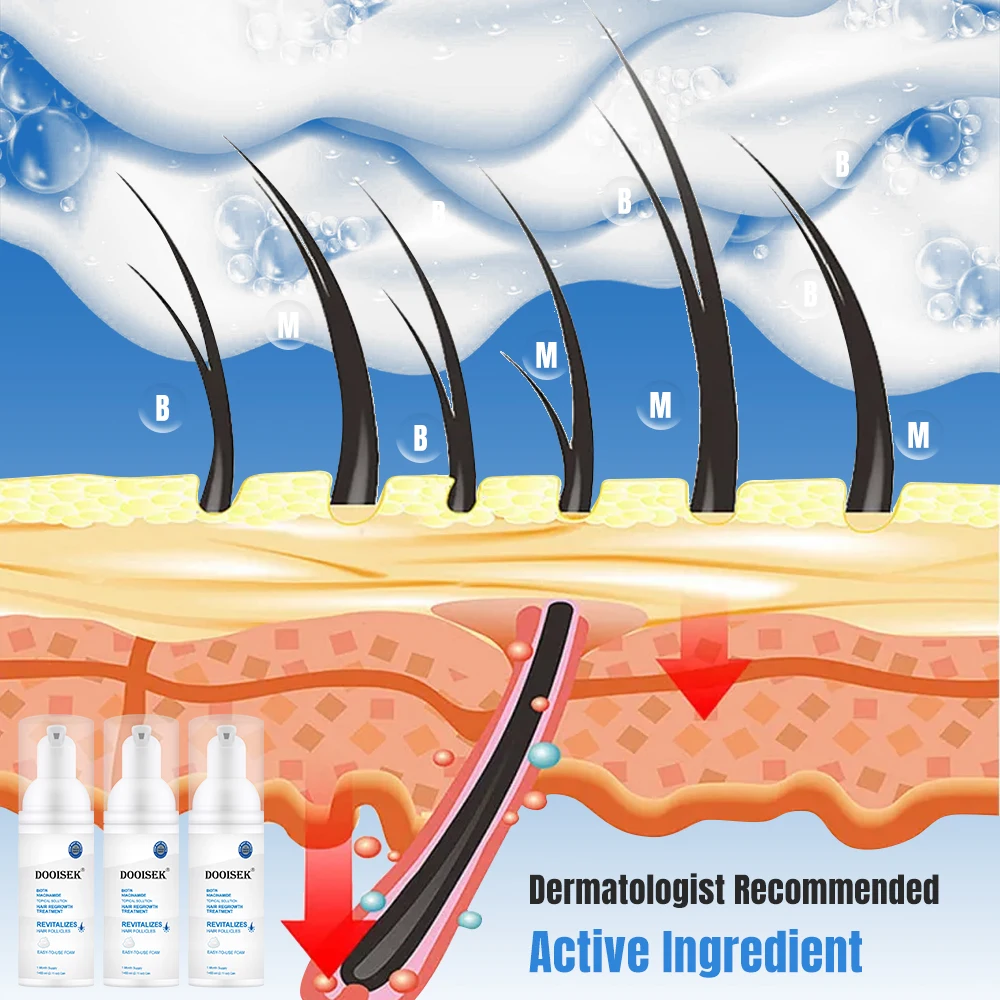 Hot Products 60ml Super Fast Hair Growth Serum Tonic 5% Hair Growth foam Anti Hair Loss Treatment