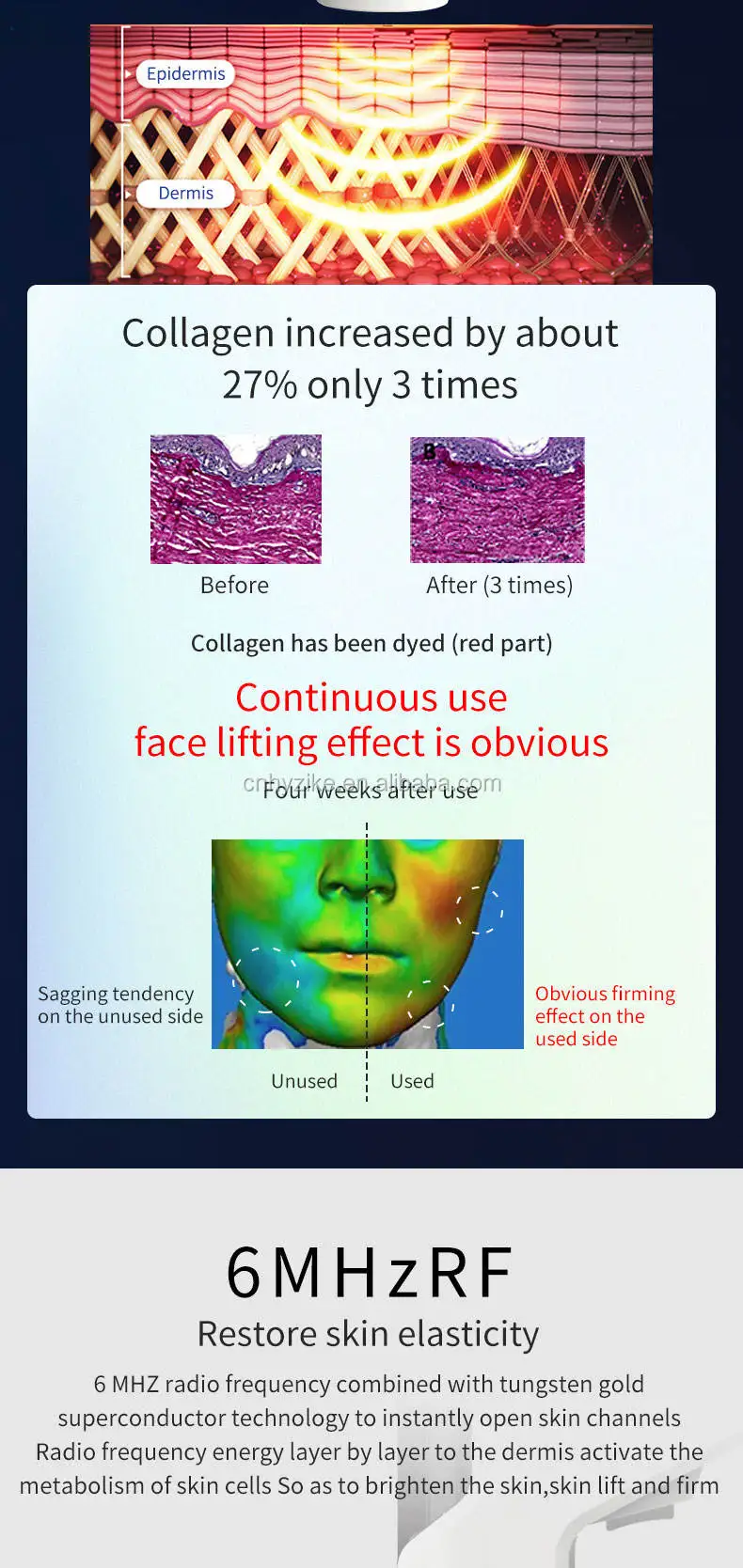 mesotherapy (10).jpg