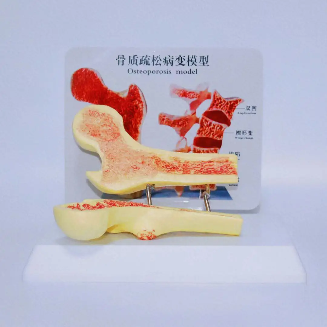 2021 new listing made of durable materials dedicated to teaching osteoporosis skeleton model