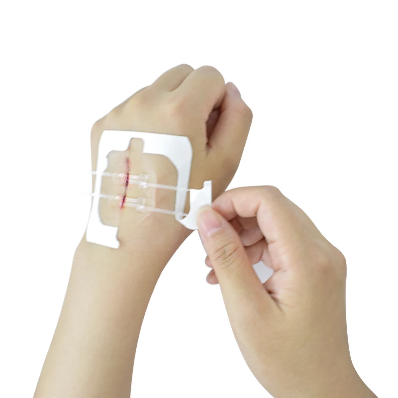 2 pcs/box,Emergency Wound Closures Device Band-Aid Adhesive Bandages,Zip stiches,Skin-Friendly