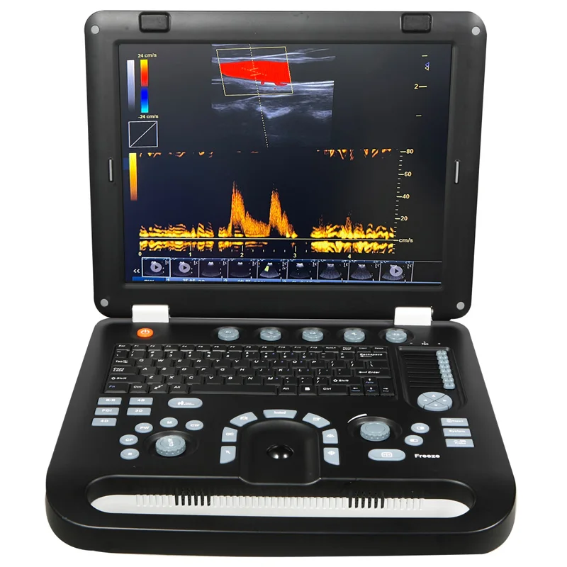 WH-29 Hot Sales color doppler ultrasound machine veterinary ultrasound machine price for laptop computer
