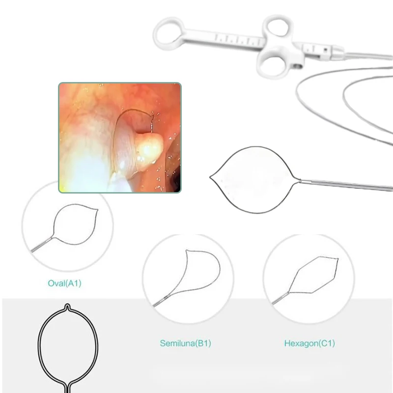 Alimentary canal Medical Disposable Polypectomy Snare