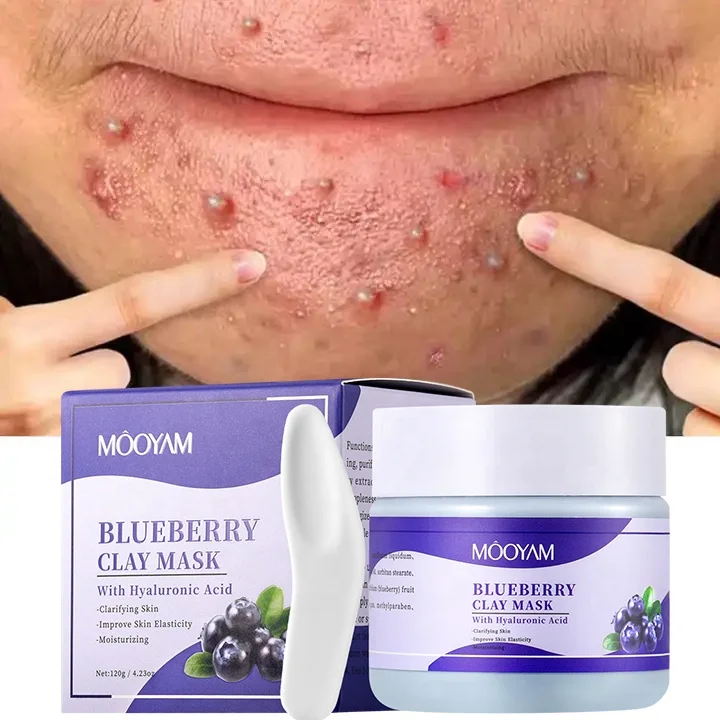 Face Clay Mask Skin Care Beauty Products Acne Remover Anti Acne Blueberry Purifying Mask Facial Clay Mud Mask