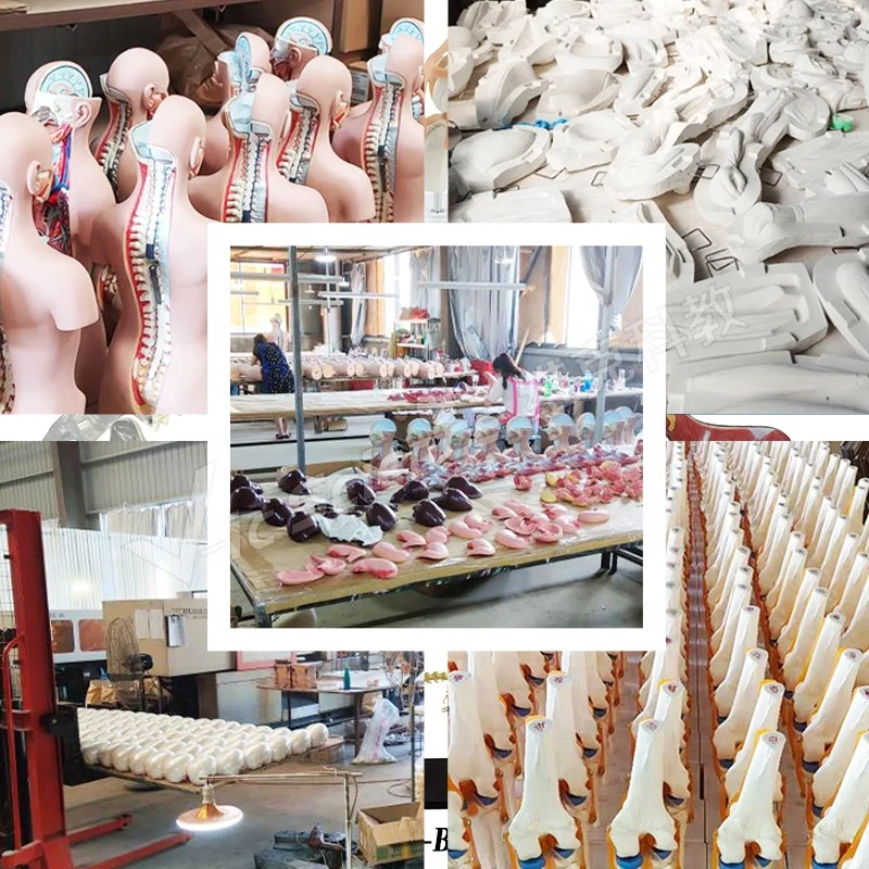 anatomical models for medical teaching stomach With Ulcers Anatomy Model human digestive system model