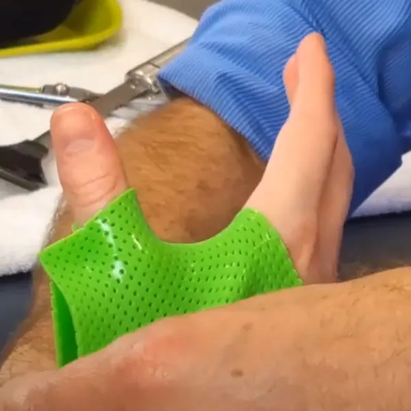 Senolo factory Low Temperature Thermoplastic External Nasal pet animal hand brace ankle Splint