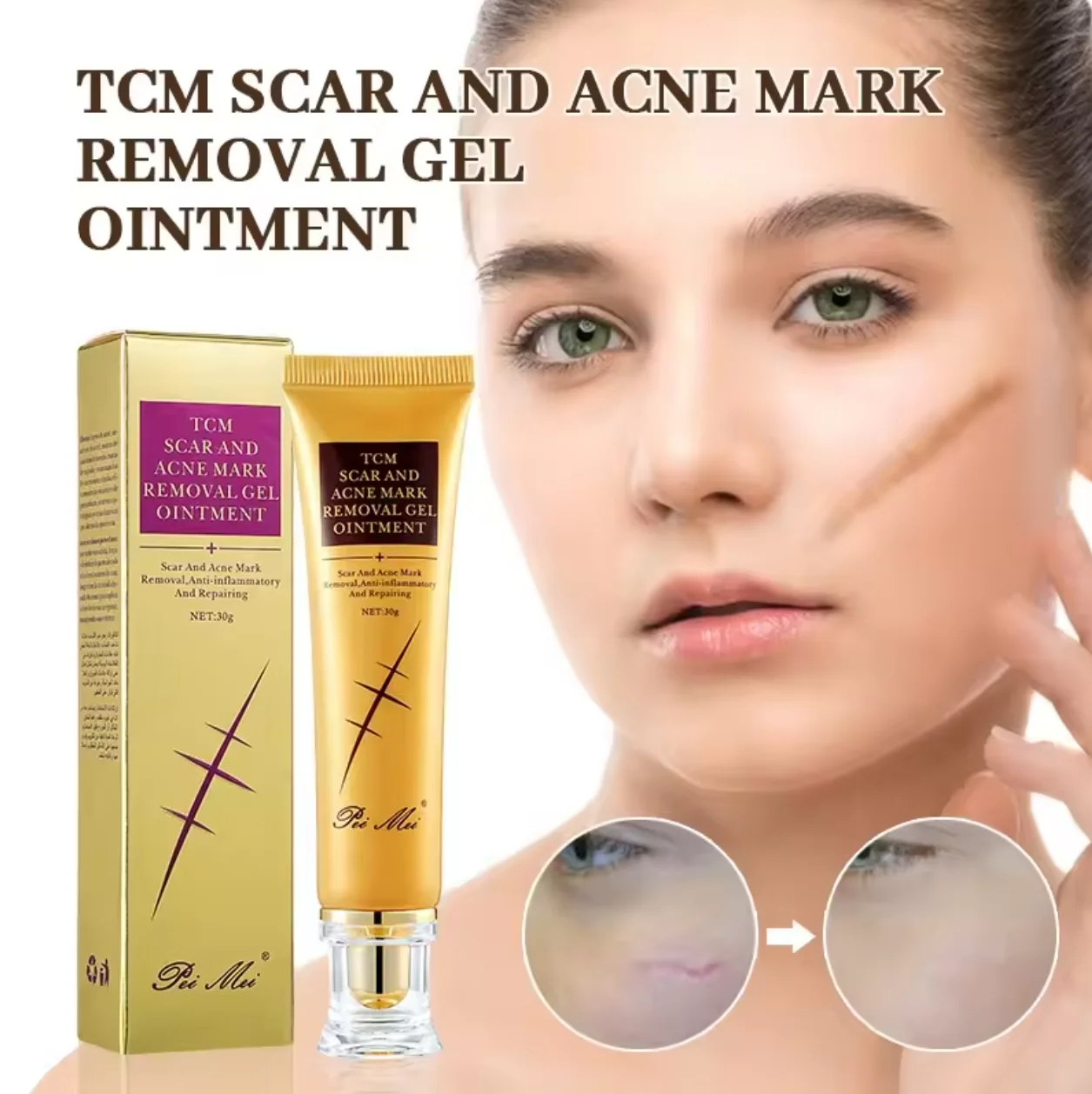 Wholesale custom face cream black spot acne whitening for face and legs old scar removing scar freckle face cream