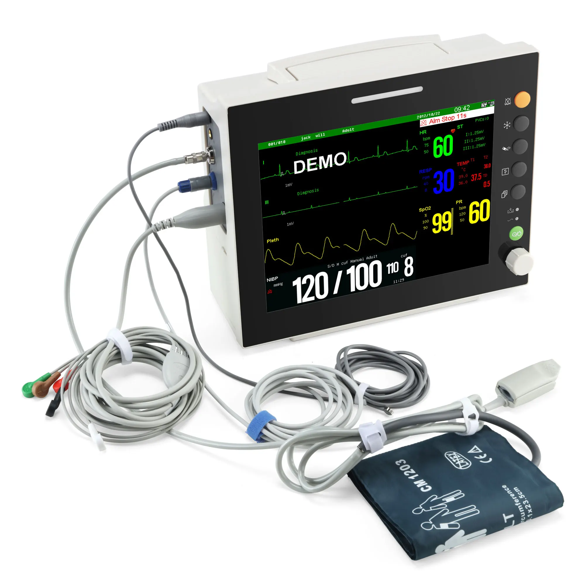 12.1 inch TFT screen ICU CCU ecg machine ambulance monitoring equipment for hospital and clinic
