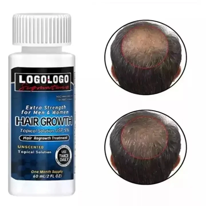 best Kirkland anti loss hair growth serum oil products fast Hair Regrowth Treatment  for bald Men