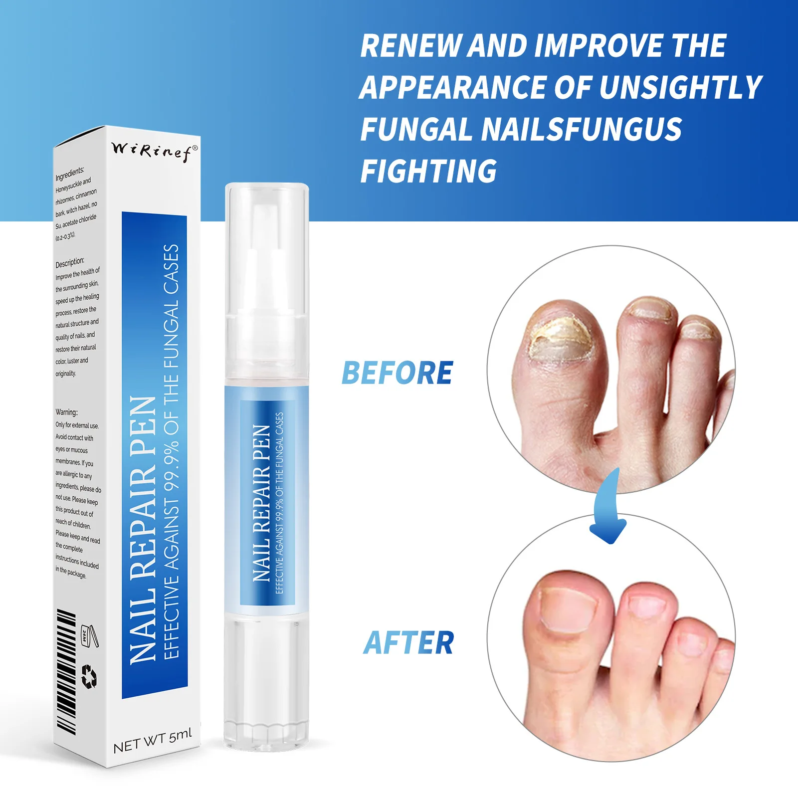 New Products Beauty Personal Care Nails Provide Nutrition Nail Care Oil Essence Kit Fungal Nail Repair Pen