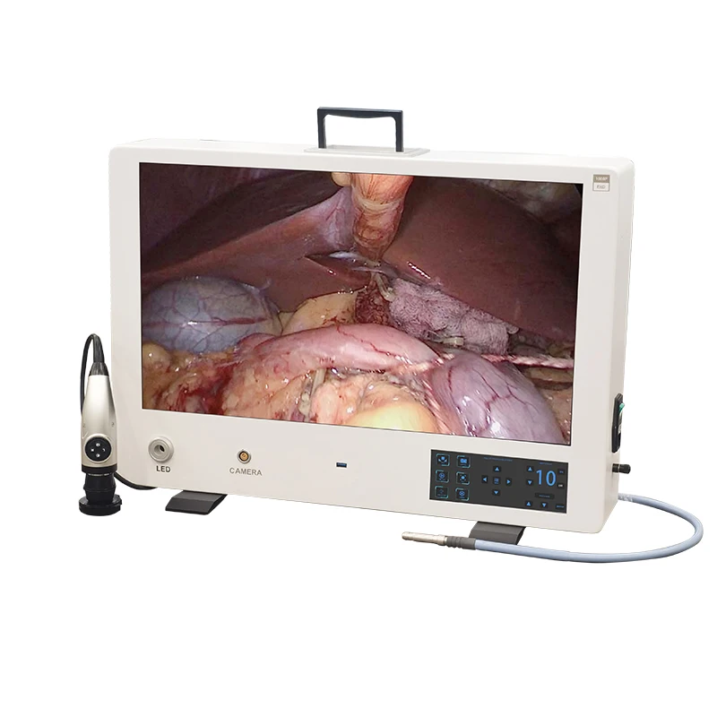 2K 4K Compact integrated Endoscopy camera system for endoscopic surgery