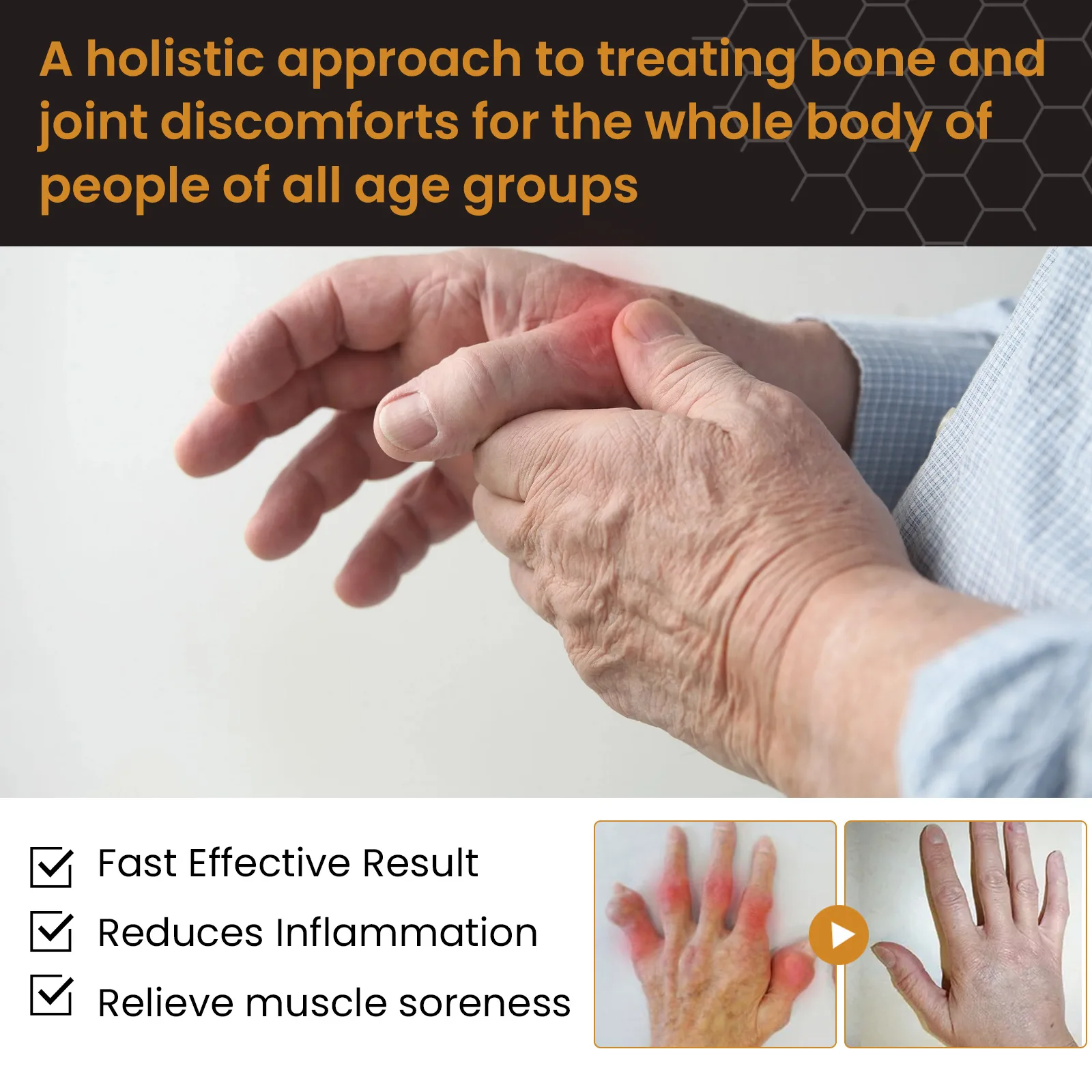 Bee venom OEM Hot Brand Relieves Pain Reducing Inflammation Improves Joint Mobility Bee Venom Melittin Joint Soothing Gel