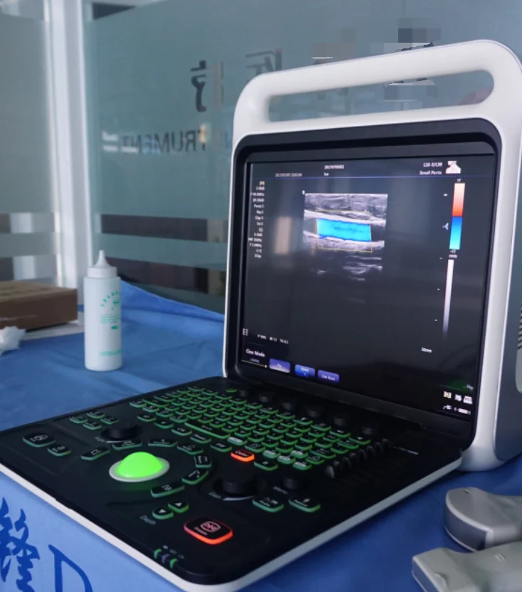 FWD-C60 Professional cardiac Portable color doppler ultrasound with 3D 4D