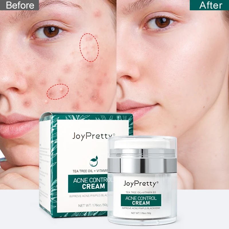 Органический крем от акне