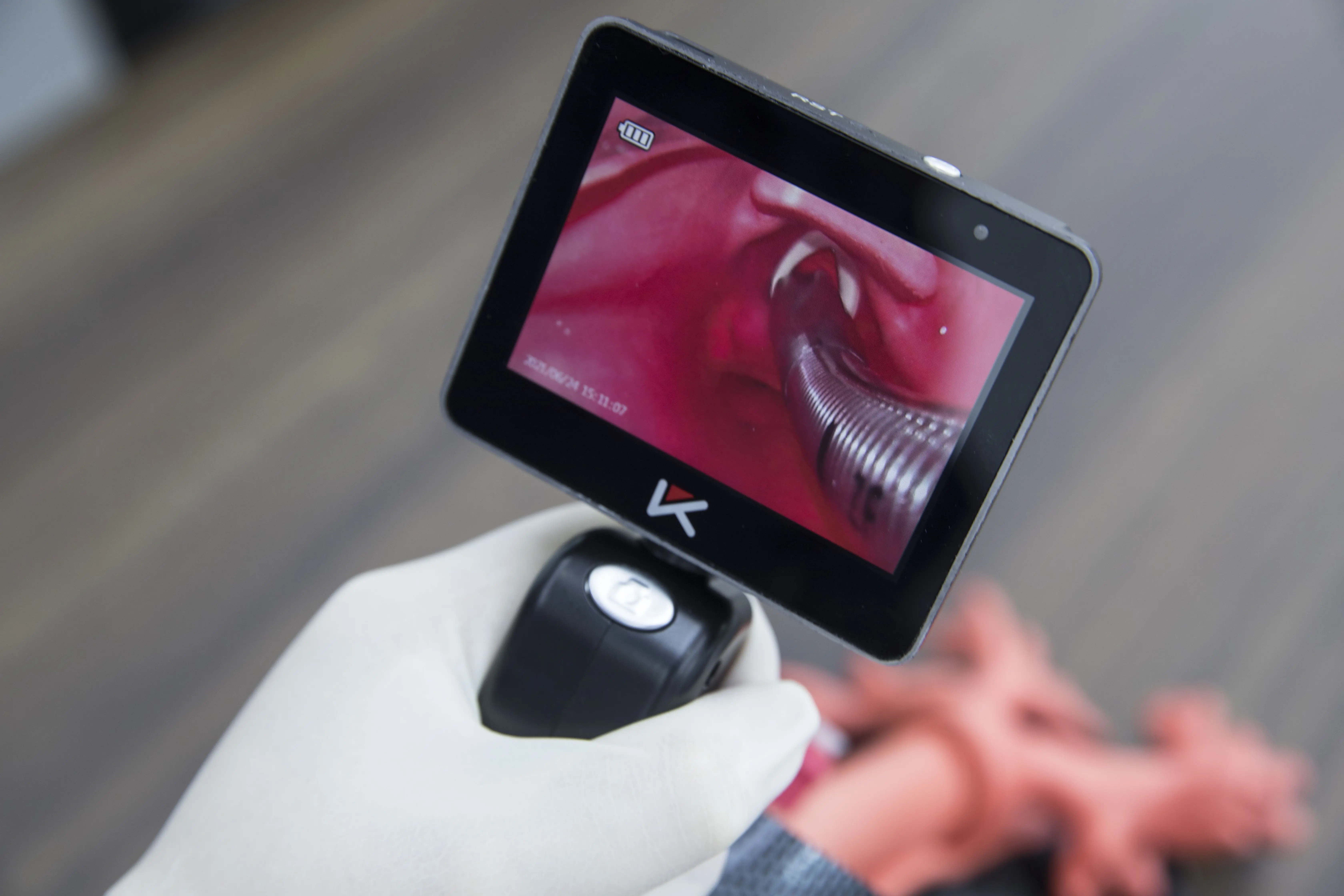 2024 Best Selling Portable Video Laryngoscope With Reusable\Disposable Blades With Lowest Price  For Chidfren And Adults