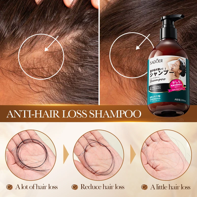 OEM SADOER Wholesale Organic Anti-dandruff Anti-hair Loss Hair Care Shampoo Nourishing Moisturizing Soft Repair Hair Shampoo