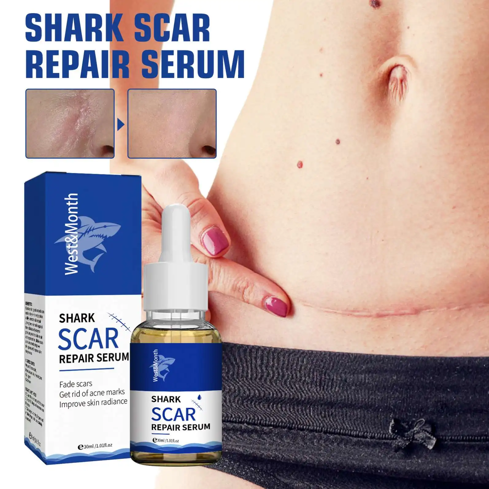 West Moon Wholesale Skin Care Scar Acne Mark Pimples Spots Repair Serum Shark Scar Treatment Oil Scar Removal Gel