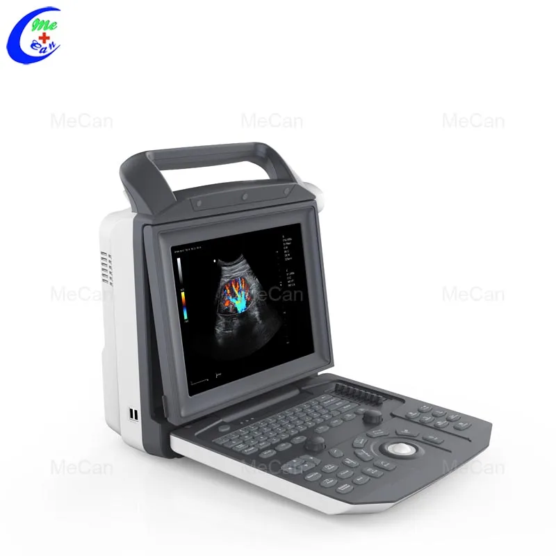 High Quality Portable Best Ultrasound Scanner Machine System 4D Ultrasound Machine With Probes For Clinic