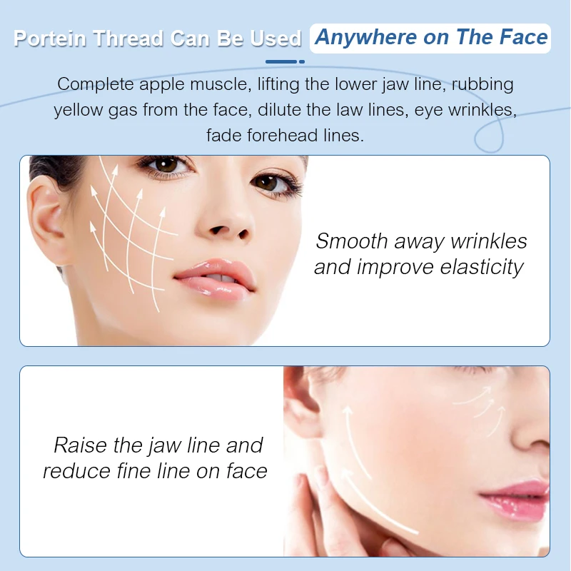 collagen thread (4).jpg