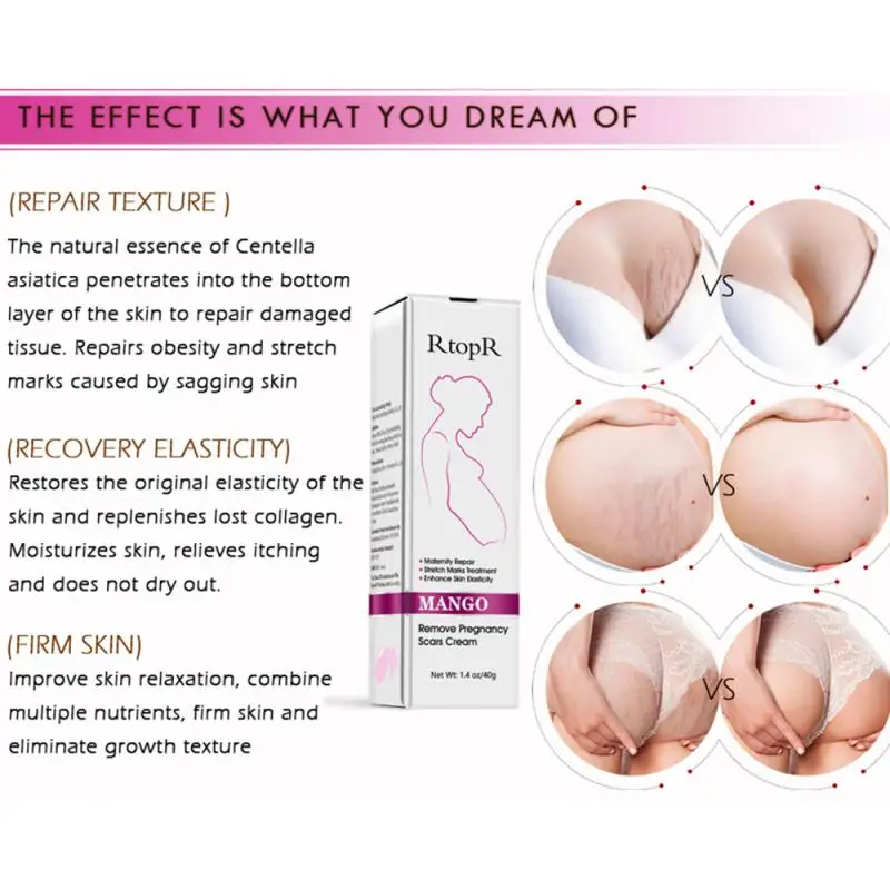 Private Label Best Rtopr 100% Natural Snail  Mango Anti Removal Stretch Mark Cream