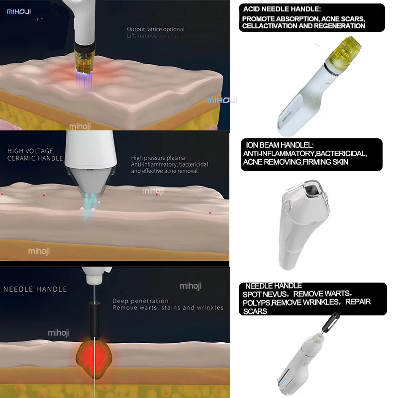 plasma pen fibroblast wrinkle removal cold plasma surgical device roller fractional hot and cold plasma machine