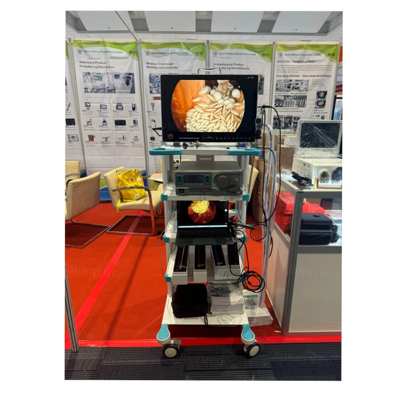 Портативный 22-дюймовый полностью в одном лапароскоп Full hd видеоэндоскоп система камеры ортопедическая Лапароскопия видеоэндоскопия хирургия