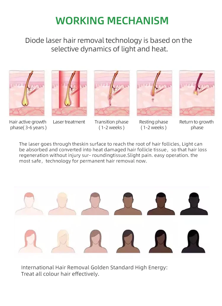 Bowket fast painless permanent hair remove diode laser for 808nm