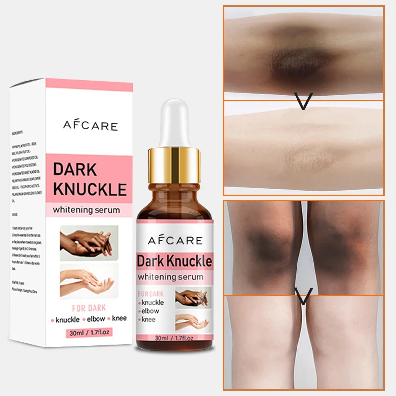 Dark Knuckles Bleaching Serum Sulfate-Free Nourishing Lightening and Vitamin C Double Glutathione Super Skin Whitening Serum