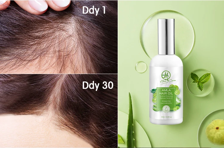 Private Label Dabur Amla Масло для волос мятный коллагеновый шампунь