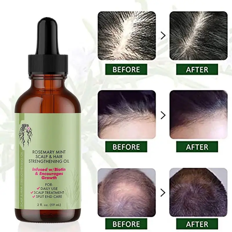 Wholesale Rosemary Hair Growth Oil Hot Selling Natural Rosemary Essential Oil For Women Hair Repair Rosemary Oil