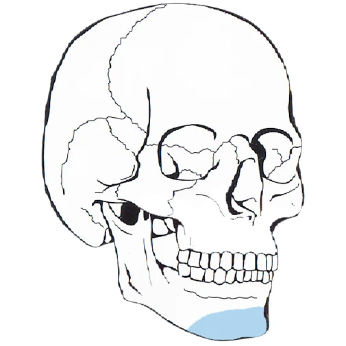 Maxilloficial Orthognathic Medical Implant Genioplasty Titanium Plates 5 Holes(0.8mm)
