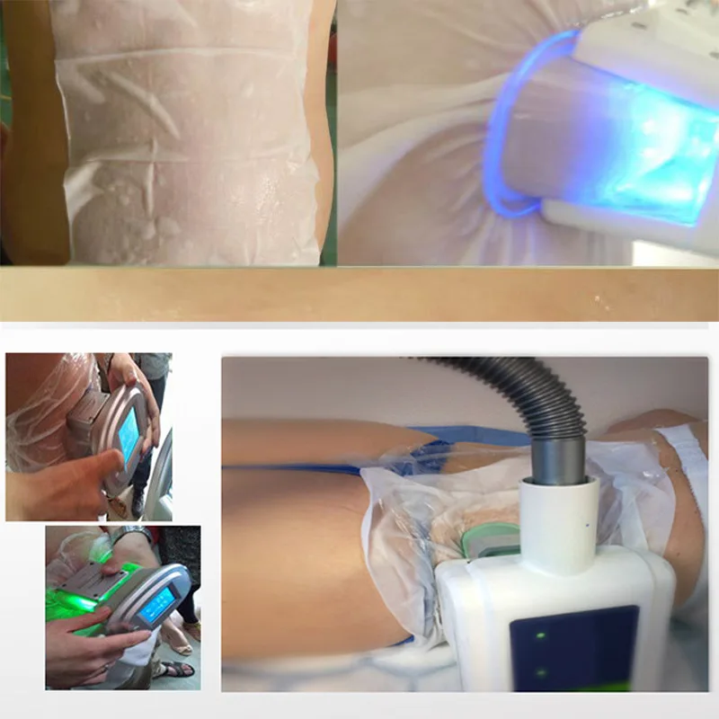 Wholesale cryo anti freeze membranes 70g/110g Antifreezing Membrane for cryolipolysis machine